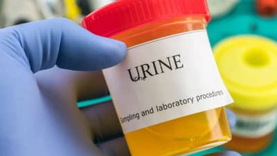 लघवीमध्ये रक्त का येतं?  कोणत्या आजाराची शक्यता? तज्ज्ञांकडून जाणून घ्या