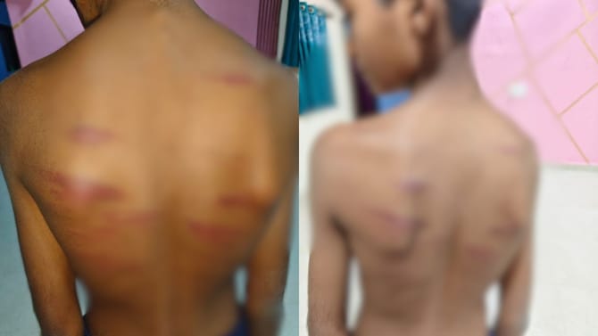 गणिताचे उत्तर चुकले, शिक्षकांसमोरच संतापलेल्या मॉनिटरकडून...,