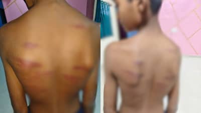 गणिताचे उत्तर चुकले म्हणून मॉनिटर संतापला, नंतर पुढे जे घडलं ते..., शाळेत नेमकं काय घडलं?