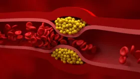 बारीक लोकांनाही होऊ शकते कोलेस्ट्रॉलची समस्या, दिसतात ही लक्षणे.