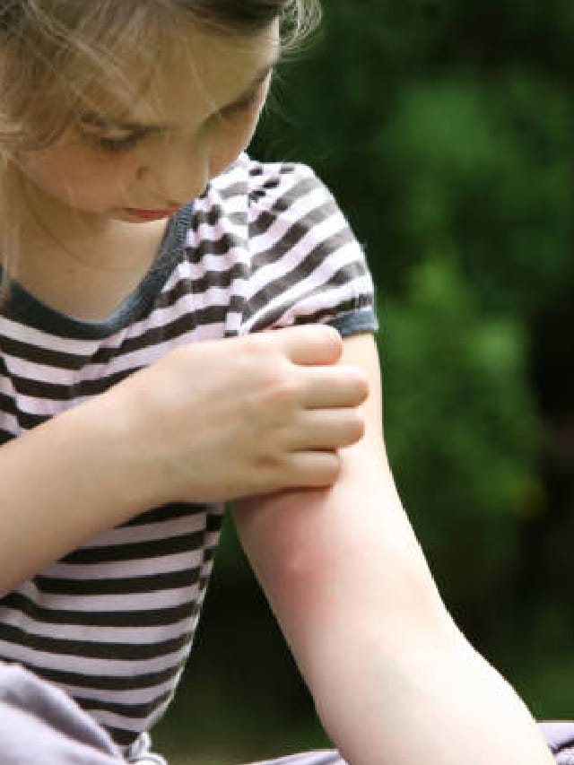 या रक्तगटाच्या लोकांना सर्वात जास्त चावतात मच्छर, कारण...