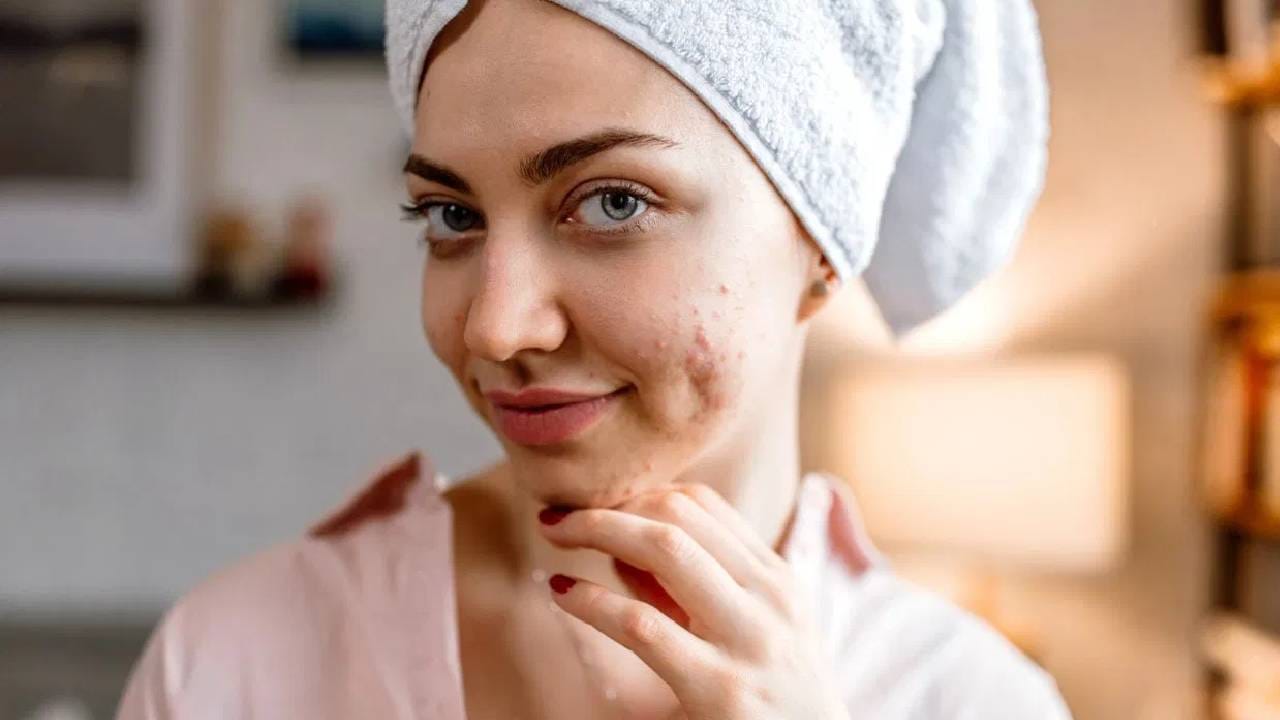 आजकाल सर्वांनाच चमकदार त्वचा हवी आहे. अनेक उपाय चांगली त्वचा मिळवण्याकरिता केले जातात. मात्र, बऱ्याचदा अर्धे माहिती असल्याने त्वचा चांगली होण्यापेक्षा त्वचा अधिक खराब होते. 