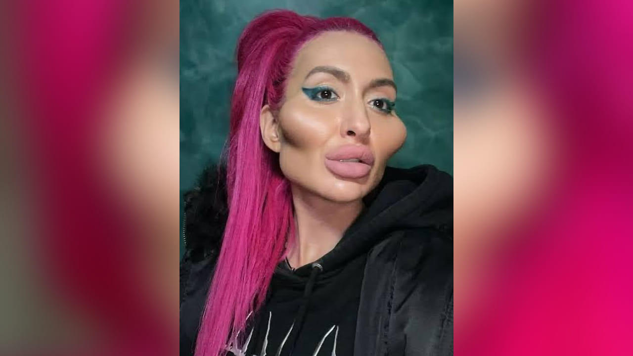 अलीकडेच अनास्तासियाने तिचे 9 वर्षांपूर्वीचे फोटो शेअर केले, ज्यामुळे अनेकजण थक्क झाले. 2017 मधील या फोटोंमध्ये ती पूर्णपणे वेगळी दिसत होती. त्या काळात तिचे गाल सामान्य होते, लांब सोनेरी केस होते आणि तिचा लुक एक फिटनेसप्रेमी मुलीसारखा होता.