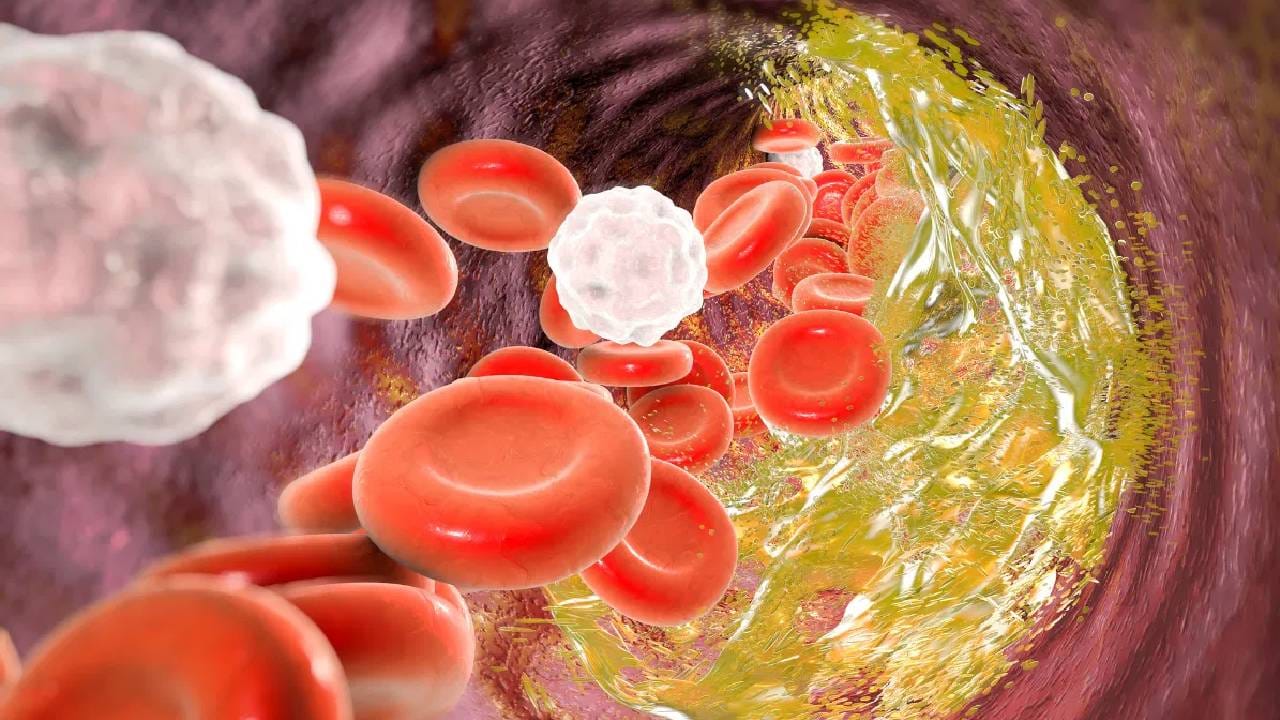 मात्र, तुम्हाला कोलेस्टेरॉलची समस्या असेल तर तुम्ही फुल-फॅट डेअरी उत्पादने टाळावीत. नाही तर तुमच्या आरोग्य समस्या कमी होण्यापेक्षा अधिक वाढतील.