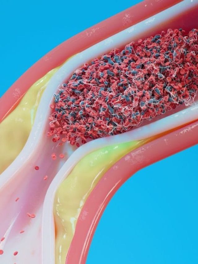 कोणते अन्नपदार्थ खाल्ल्याने कोलेस्ट्रॉलवर नियंत्रण मिळते?