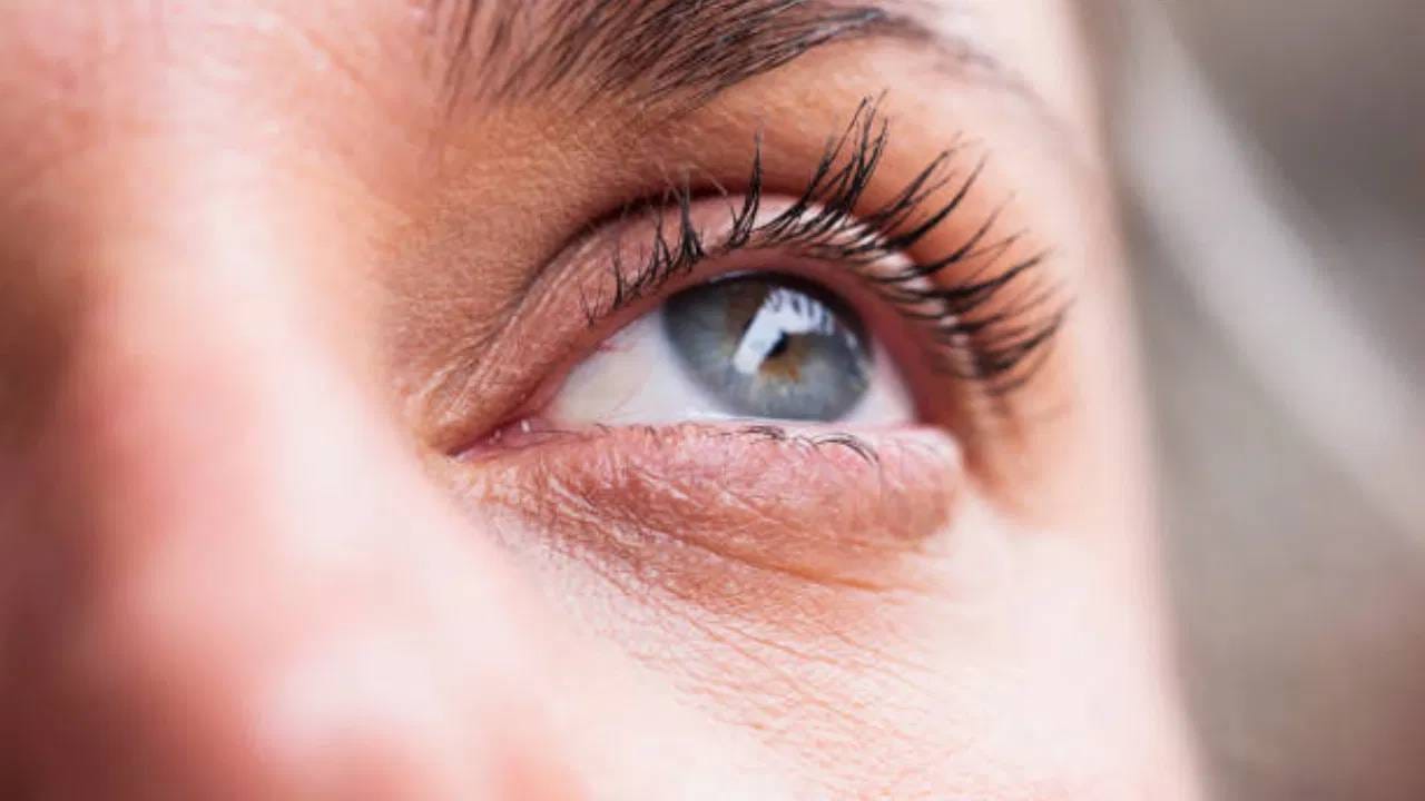 जेव्हा शरीरात बिलीरुबिन नावाचे पिवळे रंगद्रव्य जास्त प्रमाणात जमा होते तेव्हा हे होते. यामुळे डोळे पिवळे होत असतील तर त्याकडे अजिबात दुर्लक्ष करू नका. 