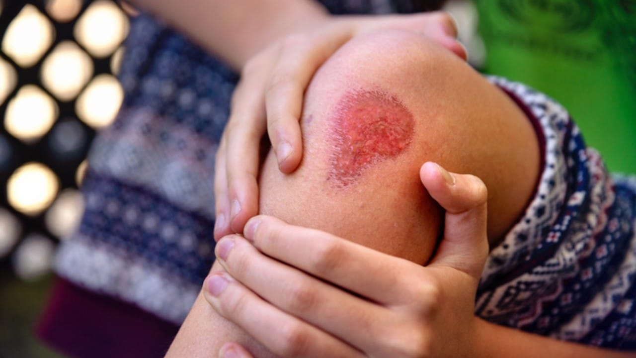 थोडक्यात सांगायचे तर, मानवी शरीर पाण्याने बनलेले असले तरी ते पाणी वेगवेगळ्या कप्प्यांमध्ये विभागलेले आहे. जखम झाल्यावर ज्या वाहिन्या कापल्या जातात, फक्त त्यात मिसळलेल्या पेशी आणि प्रथिनांमुळे त्याला वेगळी ओळख मिळते.