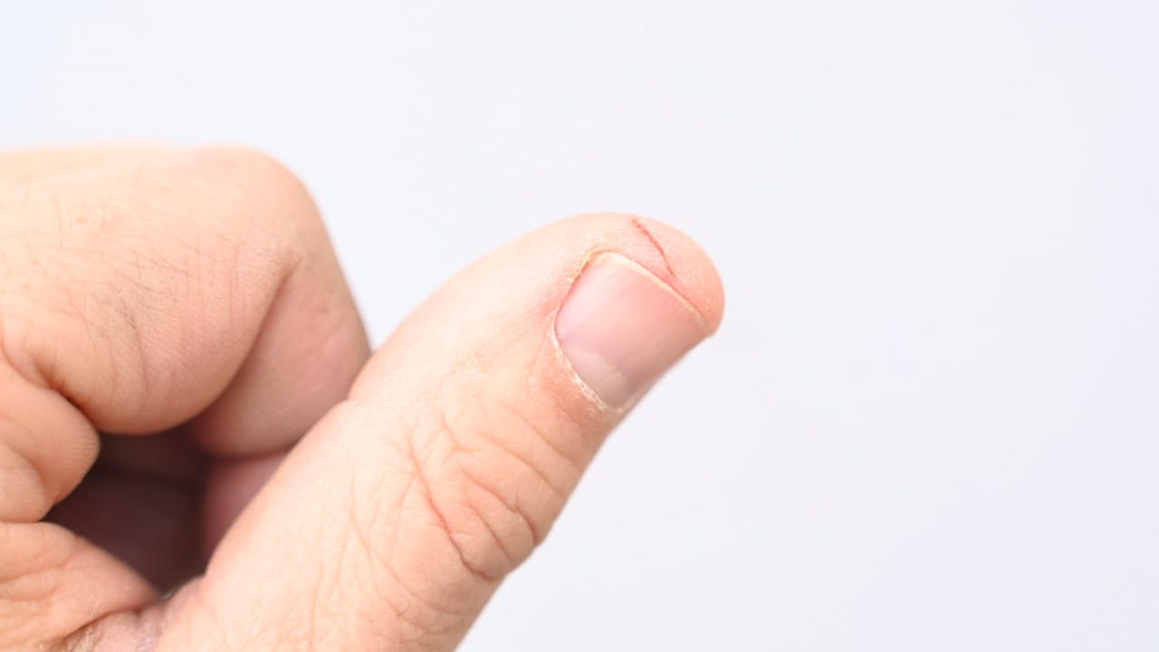 त्यामुळे, जेव्हा आपल्याला जखम होते, तेव्हा आपण केवळ पाणी गमावत नाही, तर त्या भागातील रक्तवाहिन्या फुटल्यामुळे रक्त बाहेर येते. रक्त हे स्वतः एक लिक्विड टिश्यू आहे. ज्यामध्ये प्लाझ्मा नावाचा पिवळसर द्रव आढळतो.