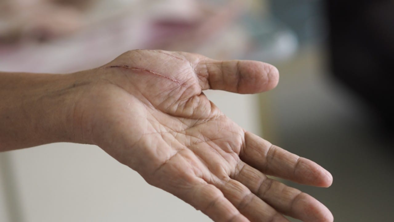 मानवी शरीरातील ७० टक्के पाणी हे मुक्त स्वरूपात (Free water) नसते. हे पाणी प्रामुख्याने आपल्या शरीरातील अब्जावधी पेशींच्या आत, पेशींच्या दरम्यान असलेल्या पोकळीत आणि रक्ताभिसरण संस्थेमध्ये साठवलेले असते.