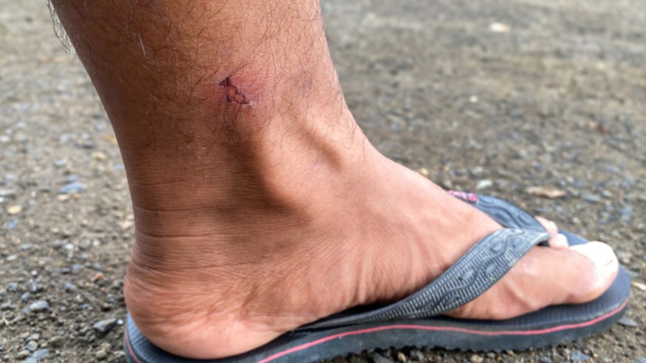 आपल्या शरीरामध्ये ७० टक्के पाणी असूनही जखम झाल्यास रक्त का निघते? असा प्रश्न अनेकांना पडतो. आज आपण याचे उत्तर जाणून घेणार आहोत.  मानवी शरीराच्या जटिल रचनेत आणि पेशींच्या विशिष्ट कार्यामध्ये याचे उत्तर दडलेले आहे.