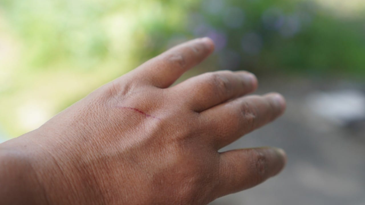 मानवी शरीराचा ७० टक्के भाग पाण्याने बनलेला आहे, हे आपल्याला लहानपणी शाळेत शिकवले जाते. पण तरीही आपण कुठेही धडपडलो, कापलं किंवा एखादी साधी जखम झाली तरी आपल्या शरीरातून पाणी न येता रक्त बाहेर येते.