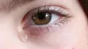 उन्हाळ्यात डोळ्यातून पाणी का येते? कारण वाचून तुम्ही देखील चकीत व्हाल.