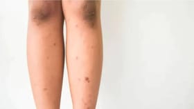 पायांवरील काळेपणा व कोरडेपणा दूर करण्यासाठी 'या' सोप्या घरगुती..