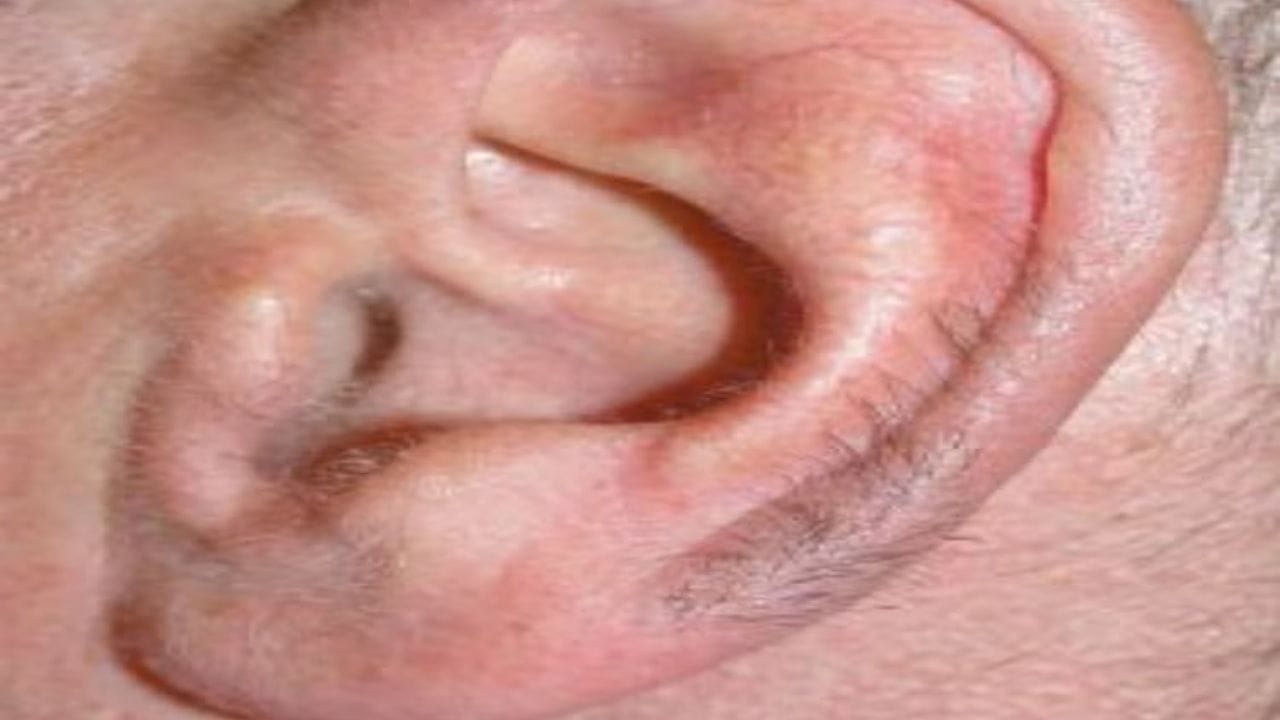 भारतीय संस्कृतीमध्ये सामुद्रिक शास्त्र हे केवळ भविष्य सांगणारे माध्यम नसून ते मानवी शरीराचे आणि स्वभावाचे विश्लेषण करणारे प्राचीन ज्ञान आहे. प्राचीन भारतीय सामुद्रिक शास्त्रामध्ये शरीराच्या प्रत्येक खुणेला अर्थ असतो. शरीराच्या प्रत्येक अवयवाप्रमाणेच कानावर असणार केस हे तुमच्या आयुष्याबद्दल आणि स्वभावाबद्दल काही खास गोष्टी सांगतात.