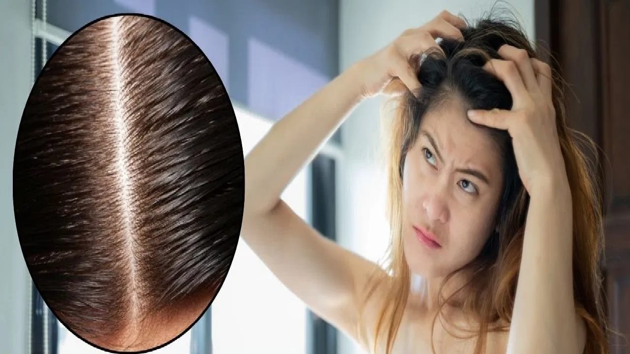 उन्हाळ्यात स्कॅल्पमध्ये खाज आणि जळजळ होतेय? तर ‘या’ नैसर्गिक गोष्टींचा करा वापर ज्याने मिळेल थंडावा