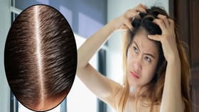 उन्हाळ्यात स्कॅल्पमध्ये खाज-जळजळ होतेय? 'या' नैसर्गिक गोष्टींचा करा.