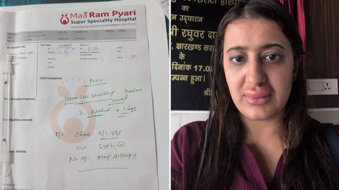 Vande Bharat ट्रेनच्या जेवणामुळे सुजले ओठ ? महिलेच्या दाव्यामुळे खळबळ