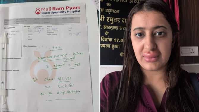 Vande Bharat ट्रेनच्या जेवणामुळे सुजले ओठ ? महिलेच्या दाव्यामुळे खळबळ