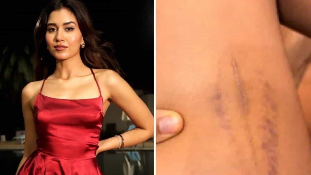 स्प्लिट्सविलाने ओलांडल्या सर्व मर्यादा; सँडलच्या हिलने मारलं, ओठांतून रक्त.. भडकले प्रेक्षक