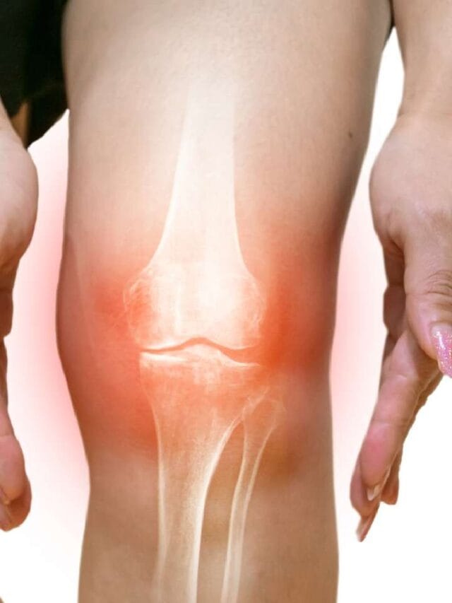 कमजोर हाडांना मजबूत बनवण्यासाठी हे उपाय कामी येतील