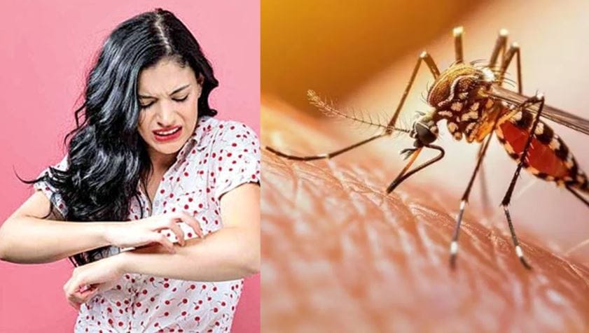 घरातील कपड्यांमुळेही खूप मच्छर होतात. तुम्ही बाहेरून आले की घाम आलेले कपडे तसेच ठेवता. त्यामुळे तुमच्या खोलीला एका प्रकारे आर्द्रता येते. ही आर्द्रता डासांच्या वाढीस पुरक असते. त्यामुळे घाण झालेले कपडे लगेच धुवून टाकावेत. 