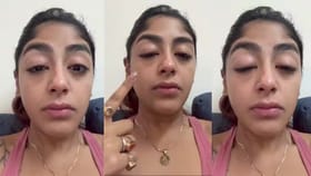 मुंबईत अभिनेत्रीला मारहाण, दात तुटला... चेहरा फोडला...,.