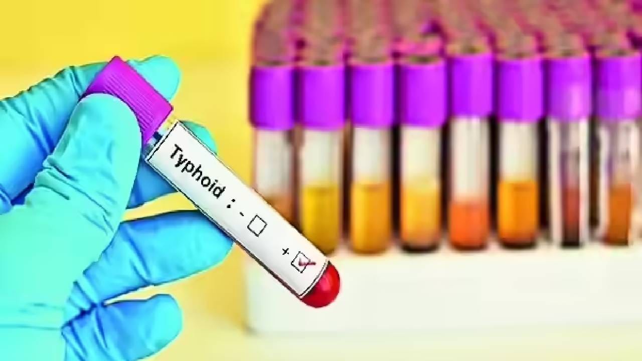 टायफॉइडबाबत 'हे' 5 मोठे गैरसमज तुमच्यासाठी ठरू शकतात धोकादायक टायफॉइडबाबत 'हे' 5 मोठे गैरसमज तुमच्यासाठी ठरू शकतात धोकादायक