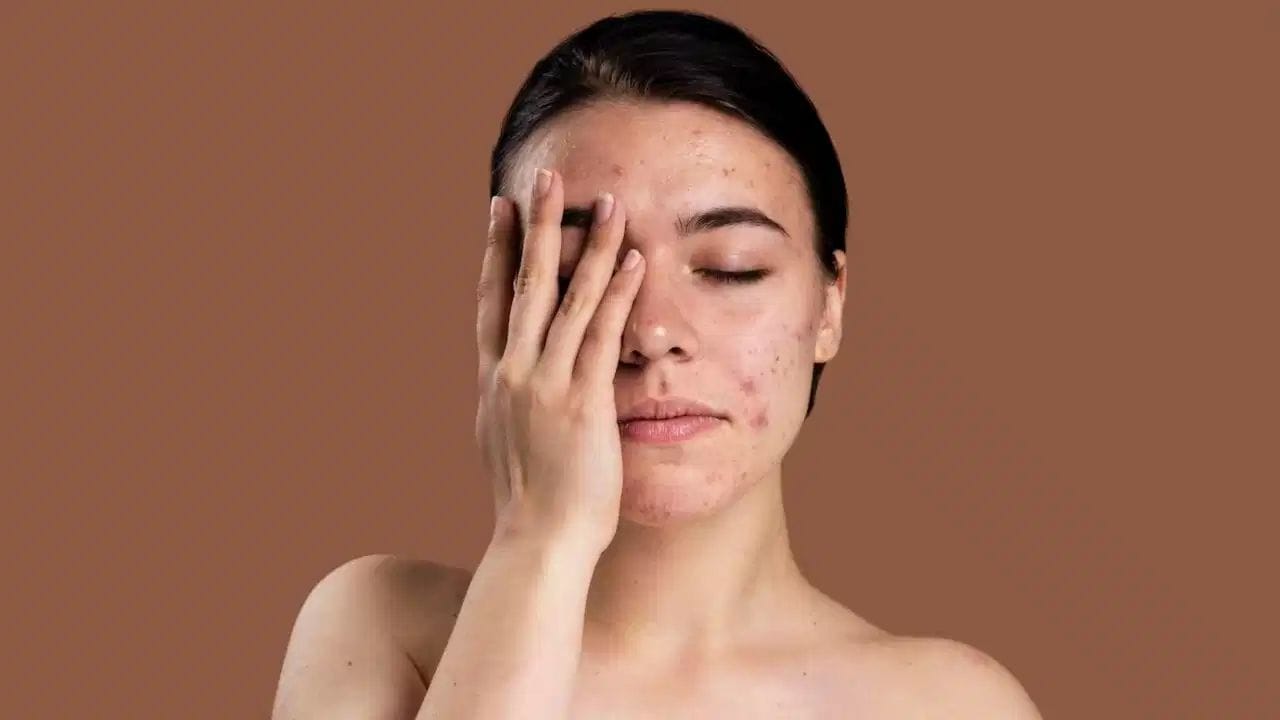उन्हाळ्याच्या हंगामात त्वचेचे रोग टाळण्याकरिता दिवसातून दोनदा अंघोळ करा. शिवाय घाम आलेले कपडे शक्यतो घालणे टाळा.