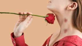 Love Bite ठरतो जीवघेणा? प्रेमीयुगलांसाठी धोका काय.. उपाय जाणून घ्या.