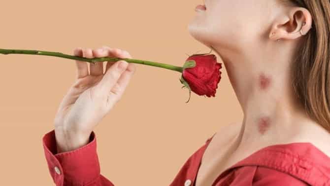 Love Bite ठरतो जीवघेणा? प्रेमीयुगलांसाठी धोका काय.. उपाय जाणून घ्या