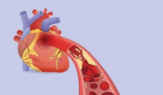अलिकडेच असे काही प्रकरण समोर आलेले आहेत, ज्यांच्या कोलेस्ट्रॉल रिपोर्टमध्ये कोणताही धोका नव्हता तरी त्यांना हृदयविकाराचा झटका आला होता. त्यामुळेच आता डॉक्टर फक्त LDL, HDL आणि ट्रायग्लिसराइड्स या घटकांसोबतच इतरही महत्त्वाच्या बाबींकडे लक्ष देतात.