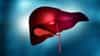 Fatty Liver Day 2026: फॅटी लिव्हर आणि कॅन्सरदरम्यान संबंध, डॉक्टरांनी सांगितले उपाय...