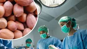 थेट फुफ्फुसात अडकला शेंगदाणा, चिमुकल्यासोबत घडलं असं काही की.....
