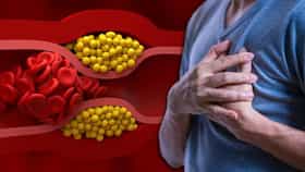 High Cholesterol: हाय कोलेस्ट्रॉलचा आजार का होतो, कोणत्या चुका जबाबदार.