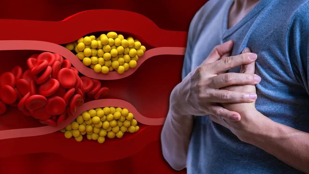 High Cholesterol : हाय कोलेस्ट्रॉलचा आजार का होतो, कोणत्या चुका ठरतात कारणीभूत.. High Cholesterol : हाय कोलेस्ट्रॉलचा आजार का होतो, कोणत्या चुका ठरतात कारणीभूत..