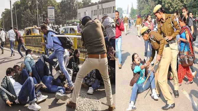 CJP आंदोलनादरम्यान पोलिसांकडून लाठीचार्ज, प्रसिद्ध कॉमेडिनयची बायको जखमी, तीव्र वेदनेनंतर मोडल्या बरगड्या