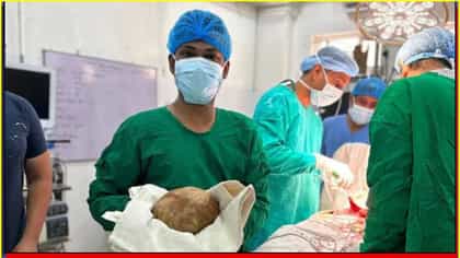 बापरे! पोटात निघाला चक्क 3 किलोचा दगड, फोटो पाहून धक्काच बसेल.
