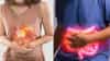 Health Tips: आठवड्यातून दोन वेळा ही भाजी खा, कधीच होणार नाही गॅस आणि ॲसिडीटीचा त्रास