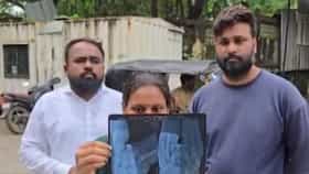 अडीच वर्षांच्या मुलाला दिलं रेबीजचं इंजेक्शन, पण एक्स-रे पाहताच ...