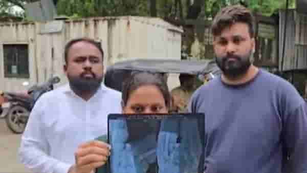 KDMC News : अडीच वर्षांच्या मुलाला दिलं रेबीजचं इंजेक्शन, पण एक्स-रे पाहताच आई हादरली..