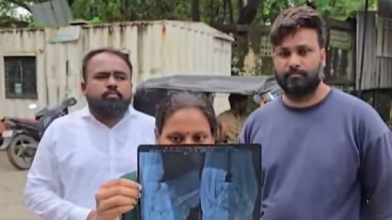 KDMC News : अडीच वर्षांच्या मुलाला दिलं रेबीजचं इंजेक्शन, पण एक्स-रे पाहताच आई हादरली.. KDMC News : अडीच वर्षांच्या मुलाला दिलं रेबीजचं इंजेक्शन, पण एक्स-रे पाहताच आई हादरली..