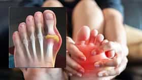Uric Acid problem: सांधेदुखीला कारण नॉनव्हेज?, रेड मीटने युरिक एसिडची पातळी वाढते, जाणून घ्या...