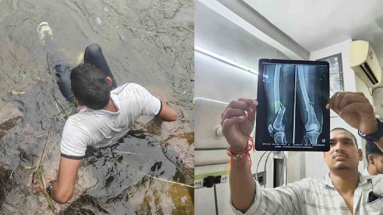 रिलसाठी 30 फुटांवरून नदीत कुदला, पायाचा x-ray बघा... रिलसाठी 30 फुटांवरून नदीत कुदला, पायाचा x-ray बघा...