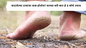 Beauty Tips : फाटलेल्या टाचांमुळे पाय खराब दिसतात? वेदना होतात, या सोप्या 5 घरगुती टिप्स गायब करतील भेगा आणि करतील पाय मऊ