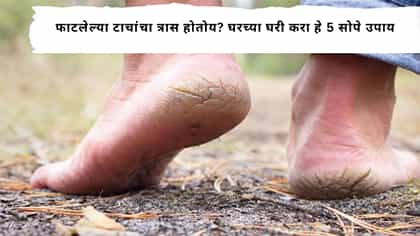 फाटलेल्या टाचांचा त्रास होतोय? घरच्या घरी करा हे ५ सोपे उपाय