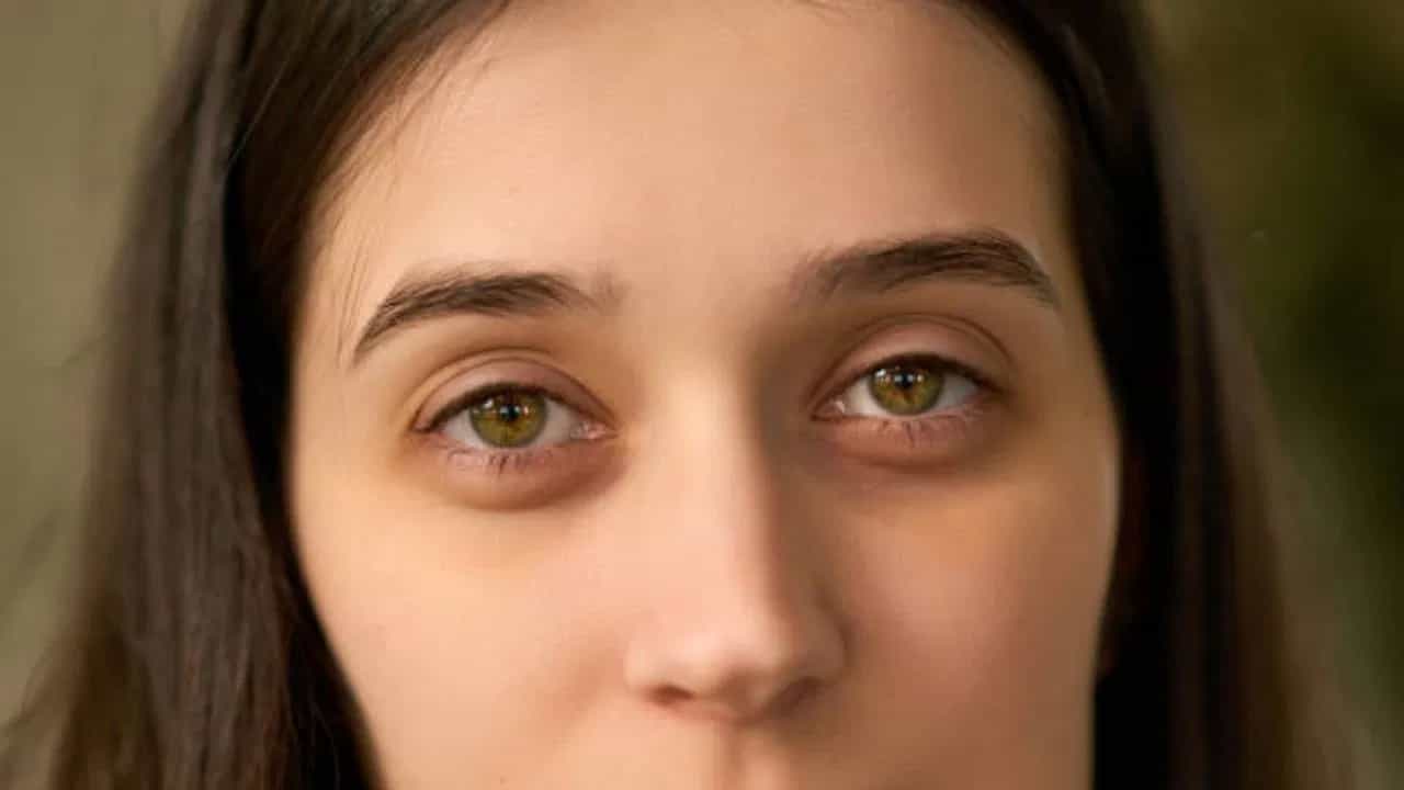 डोळ्यांखालील काळी वर्तुळे ही एक सामान्य समस्या आहे. याच काळ्या डागांमुळे चेहऱ्याचं सौंदर्य बिघडू शकतं आणि त्याचा संबंध शारीरिक आरोग्य व जीवनशैलीशी देखील असू शकतो. ब्लॅक सर्कल्सची मुख्य कारणं आणि ती कमी करण्यासाठी काय करता येईल याबद्दल जाणून घ्या.