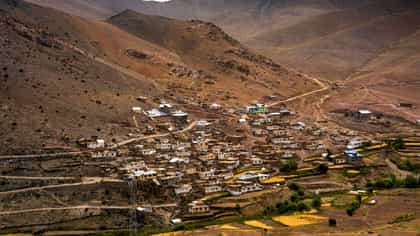 असं एक गाव जिथे फक्त एका किडनीवर जगतात लोक, कुठे आहे वन किडनी व्हिलेज?.