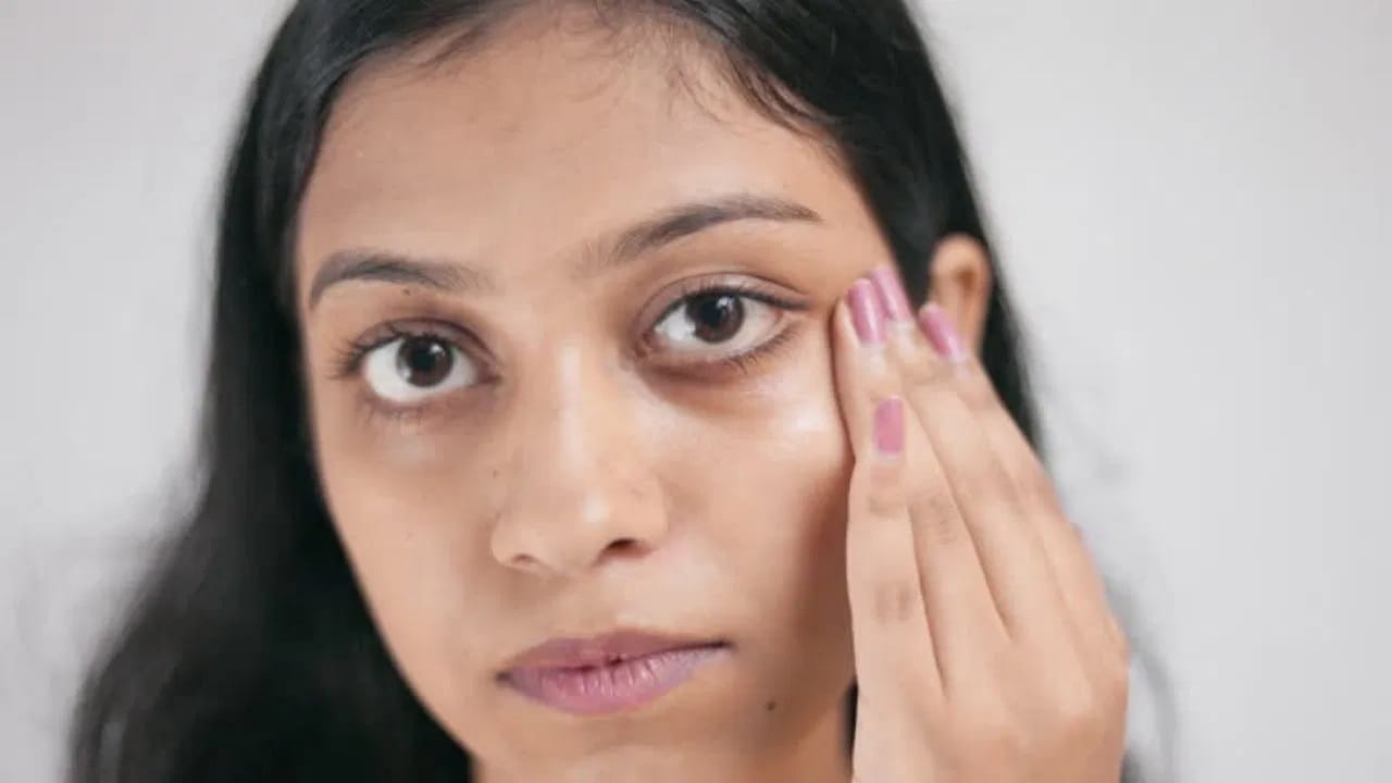 व्हिटॅमिन सी, हायलुरोनिक ॲसिड किंवा रेटिनॉल असलेले आय क्रीम वापरल्याने काही लोकांना मदत होऊ शकते. तथापि, कोणतंही उत्पादन सावधगिरीने वापरलं पाहिजे, कारण डोळ्यांच्या सभोवतालची त्वचा संवेदनशील असते.