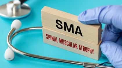 राज्यातील लहान मुलांमध्ये SMA या दुर्मिळ आजाराची लक्षणं! पालकांनी...-1753691