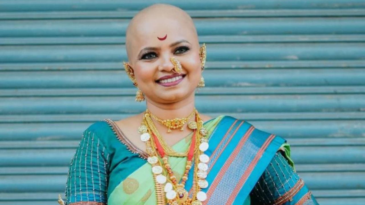 अनेक उपचार करूनही तिची ही समस्या काही दूर झाली नाही. सततच्या केसगळतीमध्ये तिच्याकडे फक्त एकच उपाय होता, तो म्हणजे हेअर टान्सप्लांट करणे. पण तिने सत्य जे काही आहे ते स्वीकारले.